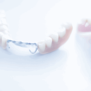 Removable Prosthodontics