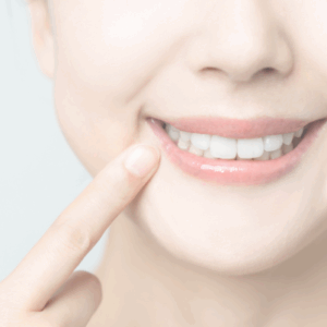 Smile Enhancement